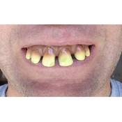 Fake Funny Teeth